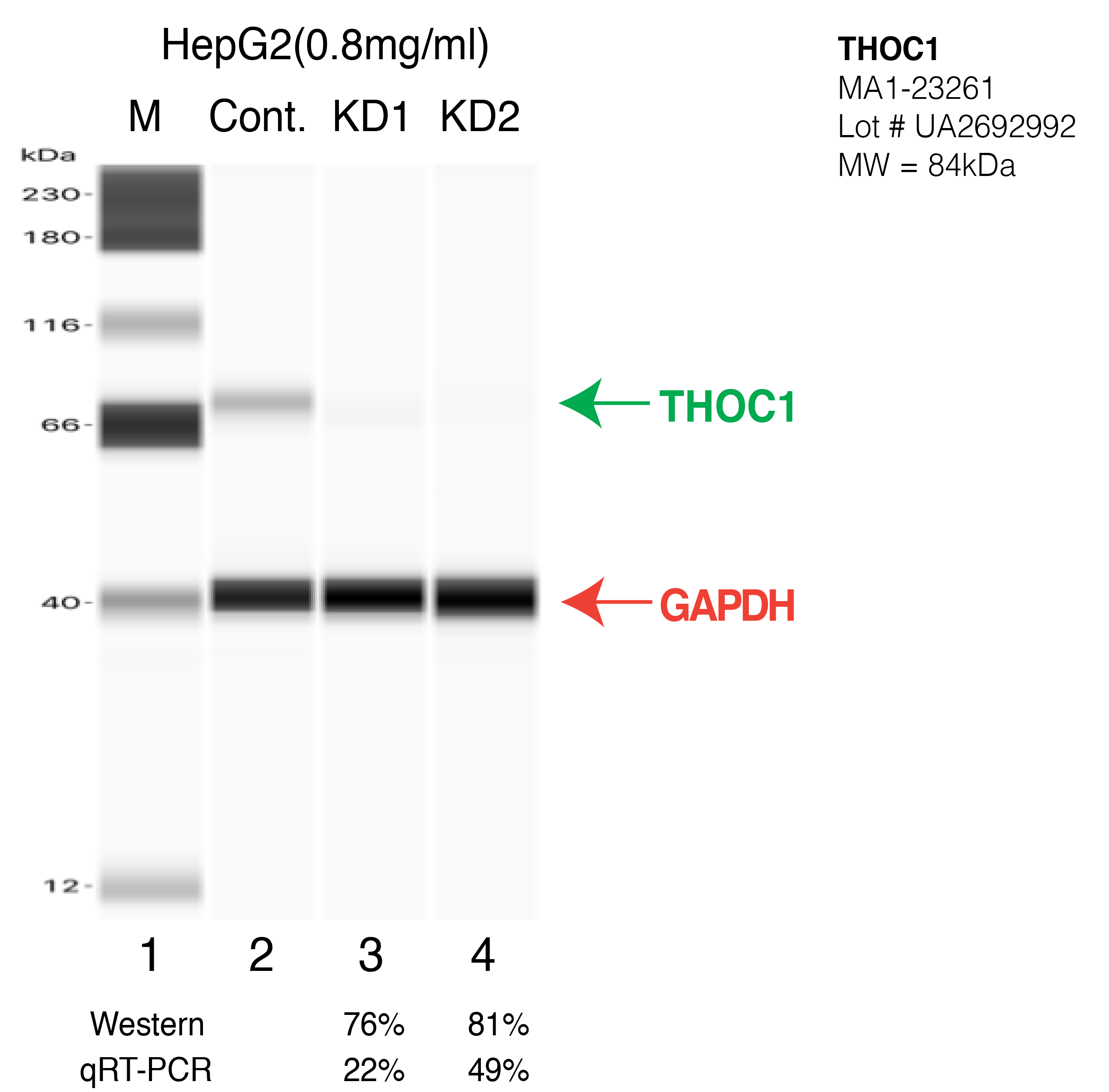 THOC1-HEPG2-CRISPR-MA1-23261.png<br>Caption: Western blot following CRISPR against THOC1 in HepG2 whole cell lysate using THOC1 specific antibody. Lane 1 is a ladder, lane 2 is HepG2 non-targeting control knockdown, lane 3 and 4 are two different CRISPR against THOC1. THOC1 protein appears as the green arrow, GAPDH serves as a control and appears in red arrow.