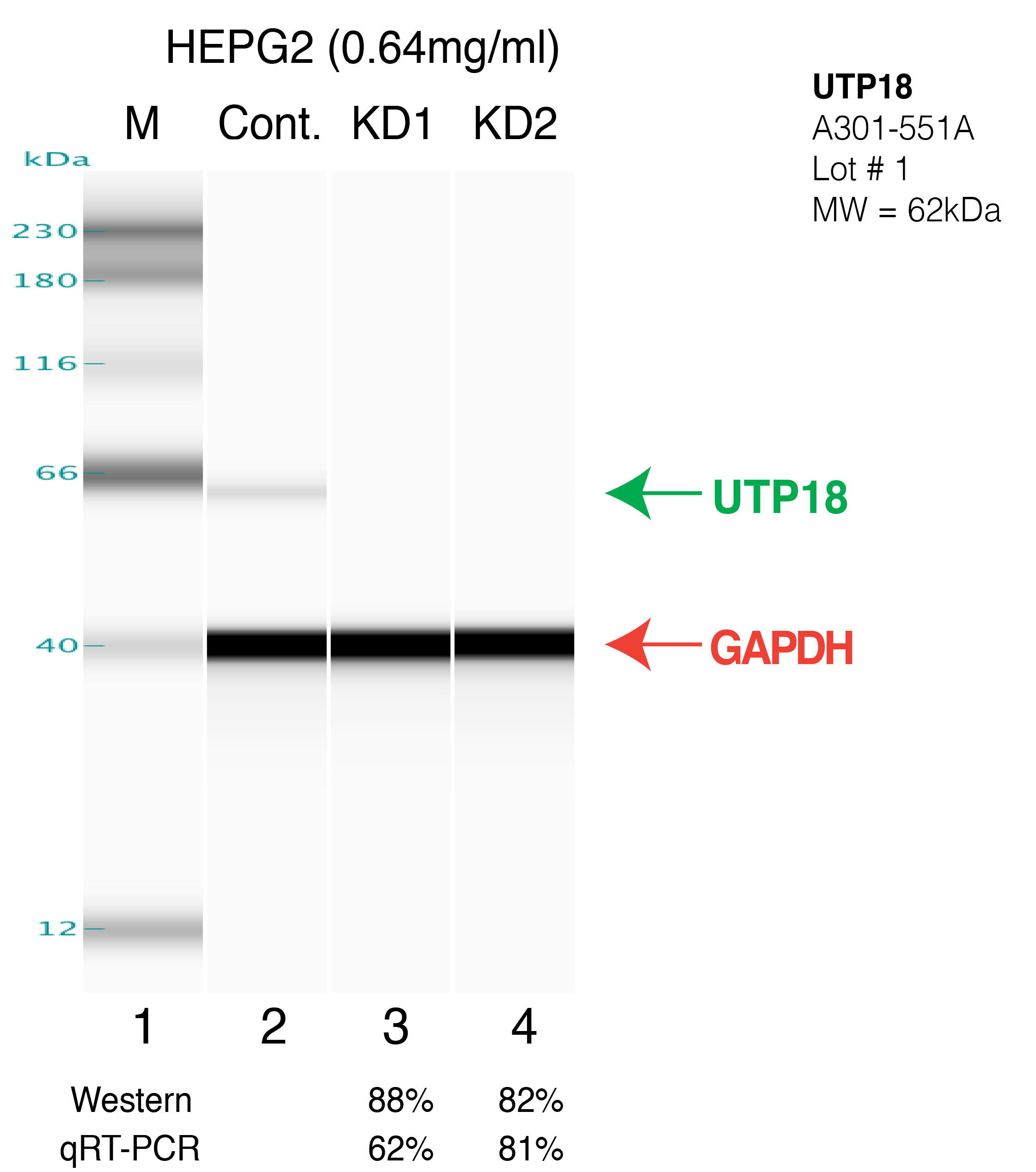 UTP18-HEPG2.png<br>Caption: Western blot following shRNA against UTP18 in HepG2 whole cell lysate using UTP18 specific antibody. Lane 1 is a ladder, lane 2 is HepG2 non-targeting control knockdown, lane 3 and 4 are two different shRNAs against UTP18. UTP18 protein appears as the green arrow, GAPDH serves as a control and appears in red arrow.