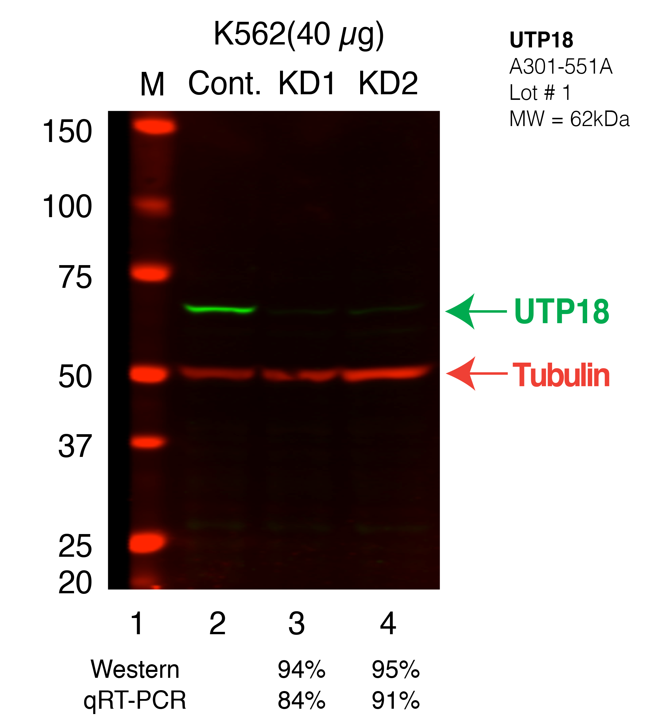 UTP18-K562_Secondary_Western.png<br>Caption: Western blot following shRNA against UTP18 in K562 whole cell lysate using UTP18 specific antibody. Lane 1 is a ladder, lane 2 is K562 non-targeting control knockdown, lane 3 and 4 are two different shRNAs against UTP18.UTP18 protein appears as the green band, Tubulin serves as a control and appears in red.