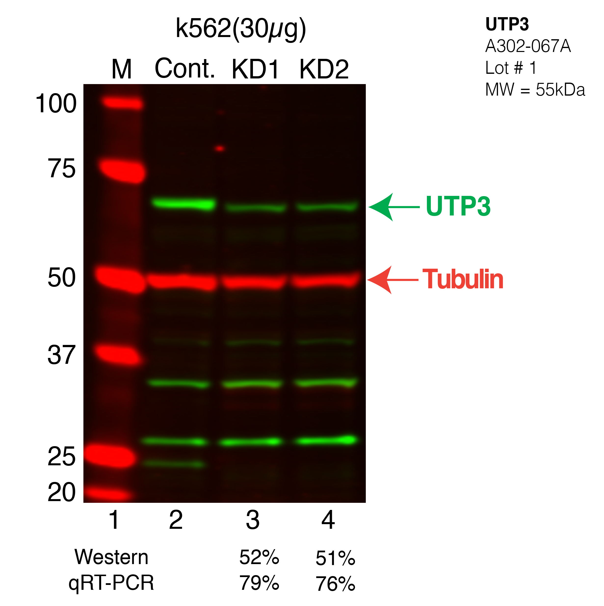 UTP3-k562.png<br>Caption: Western blot following shRNA against UTP3 in k562 whole cell lysate using UTP3 specific antibody. Lane 1 is a ladder, lane 2 is k562 non-targeting control knockdown, lane 3 and 4 are two different shRNAs against UTP3. UTP3 protein appears as the green band, Tubulin serves as a control and appears in red.