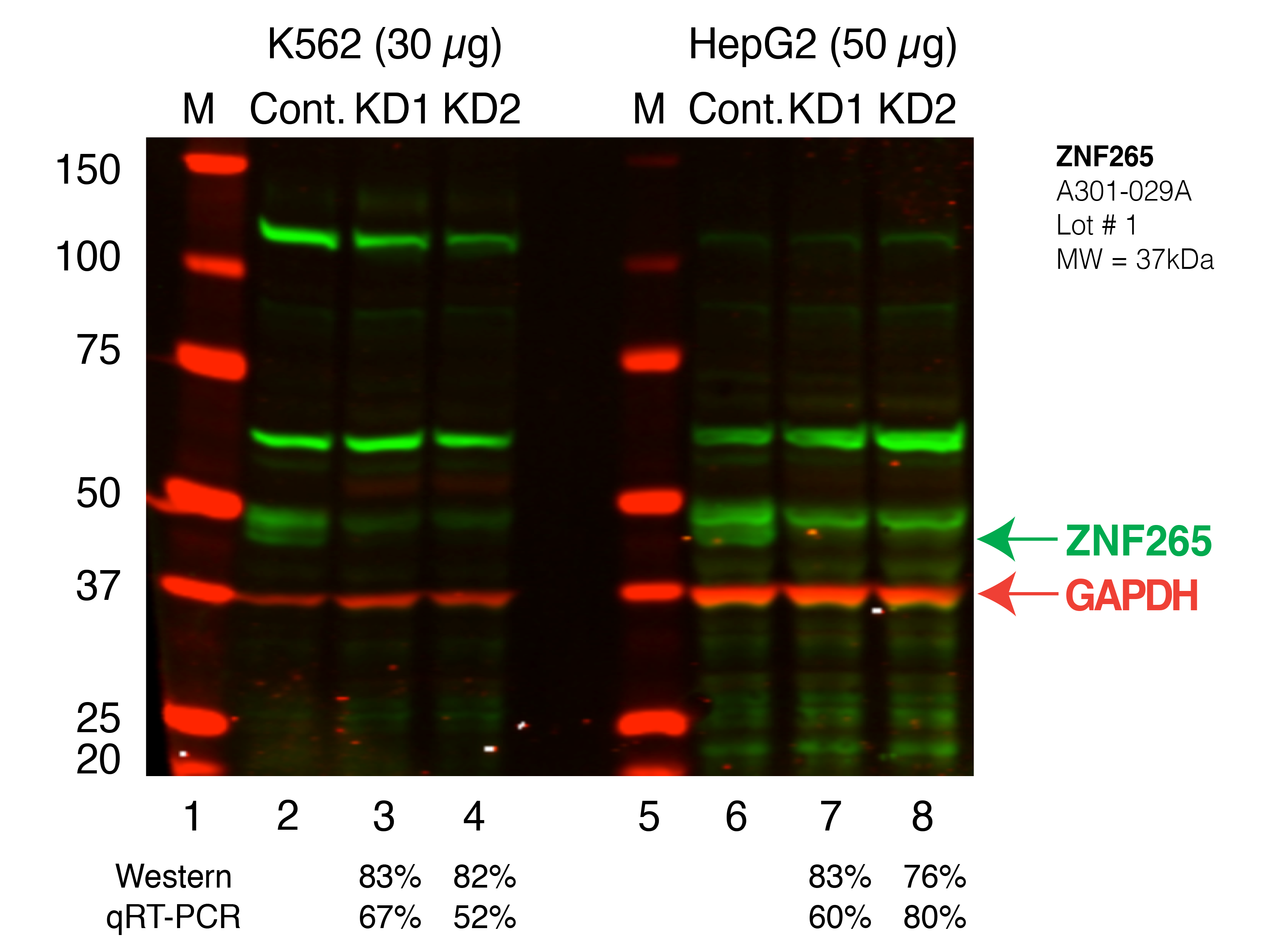 ZNF265_Secondary_Western.png<br>Caption: Western blot following shRNA against ZNF265 in K562 and HepG2 whole cell lysate using ZNF265 specific antibody. Lane 1 is a ladder, lane 2 is K562 non-targeting control knockdown, lane 3 and 4 are two different shRNAs against ZNF265. Lanes 5-8 follow the same pattern, but in HepG2. ZNF265 protein appears as the green band, GAPDH serves as a control and appears in red.