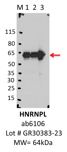 Abcam_ab6106_GR30383-23_HNRNPL.png<br>Caption: IP-WB analysis of K562 whole cell lysate using HNRNPL specific antibody. Lane 1 is 2.5% of five million whole cell lysate Input, lane 2 is 2.5% of supernatant after immunoprecipitation and Lane 3 is 50% of IP enrichment using mouse monoclonal Anti-hnRNP L antibody [4D11]. This antibody passes preliminary validation and will be further pursued for primary and secondary validation.