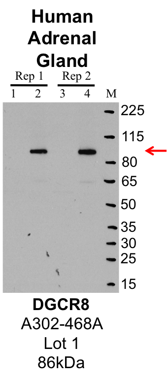 AdrenalGland_Bethyl_A302-468A_1_DGCR8.png<br>Caption: IP-Western Blot analysis of human adrenal gland lysate using DGCR8 specific antibody. Lane 1 is 1% of 10 million tissue lysate input and lane 2 is 10% of IP enrichment using rabbit polyclonal anti-DGCR8 antibody (lanes under 'DGCR8')). Lanes 3 and 4 indicate a technical replicate of lanes 1 and 2.