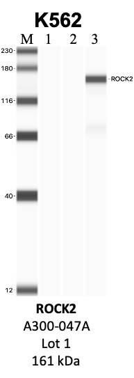 Bethyl_A300-047A_1_ROCK2.png<br>Caption: IP-WB analysis of K562 whole cell lysate using the ROCK2 specific antibody, A300-047A. Lanes 1 and 2 are 2.5% of five million whole cell lysate input and 50% of IP enrichment, respectively, using a normal IgG antibody. Lane 3 is 50% of IP enrichment from five million whole cell lysate using the ROCK2-specific antibody, A300-047A. The same antibody was used to detect protein levels via Western blot. This antibody passes preliminary validation and will be further pursued for secondary validation. *NOTE* Protein sizes are taken from Genecards.org and are only estimates based on sequence. Actual protein size may differ based on protein characteristics and electrophoresis method used.