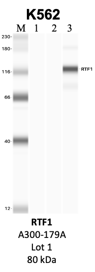 Bethyl_A300-179A_1_RTF1.png<br>Caption: IP-WB analysis of K562 whole cell lysate using the RTF1 specific antibody, A300-179A. Lanes 1 and 2 are 2.5% of five million whole cell lysate input and 50% of IP enrichment, respectively, using a normal IgG antibody. Lane 3 is 50% of IP enrichment from five million whole cell lysate using the RTF1-specific antibody, A300-179A. The same antibody was used to detect protein levels via Western blot. This antibody passes preliminary validation and will be further pursued for secondary validation. *NOTE* Protein sizes are taken from Genecards.org and are only estimates based on sequence. Actual protein size may differ based on protein characteristics and electrophoresis method used.