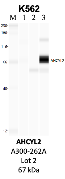 Bethyl_A300-262A_2_AHCYL2.png<br>Caption: IP-WB analysis of K562 whole cell lysate using the AHCYL2 specific antibody, A300-262A. Lanes 1 and 2 are 2.5% of five million whole cell lysate input and 50% of IP enrichment, respectively, using a normal IgG antibody. Lane 3 is 50% of IP enrichment from five million whole cell lysate using the AHCYL2-specific antibody, A300-262A. The same antibody was used to detect protein levels via Western blot. This antibody passes preliminary validation and will be further pursued for secondary validation. *NOTE* Protein sizes are taken from Genecards.org and are only estimates based on sequence. Actual protein size may differ based on protein characteristics and electrophoresis method used.