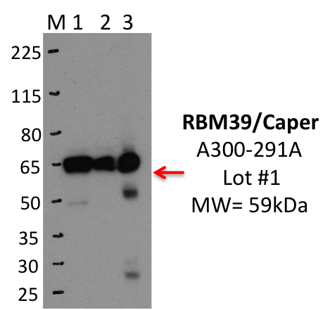 Bethyl_A300-291A_1_RBM39.png<br>Caption: IP-WB analysis of K562 whole cell lysate using RBM39 specific antibody. Lane 1 is 2.5% of 0.5mg input lysate, lane 2 is 2.5% of supernatant after immunoprecipitation and Lane 3 is 50% of IP enrichment using rabbit polyclonal anti-Caper antibody. This antibody passes preliminary validation and will be further pursued for primary and secondary validation.