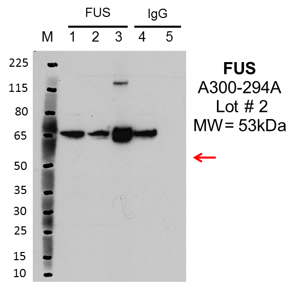 Bethyl_A300-294A_2_FUS.png<br>Caption: IP-Western blot analysis of K562 whole cell lysate using FUS specific antibody. Lane 1 is 2.5% of 0.5mg input lysate, lane 2 is 2.5% of supernatant after immunoprecipitation and Lane 3 is 50% of IP enrichment using rabbit polyclonal FUS antibody. This antibody passes preliminary validation and will be further pursued for primary and secondary validation.