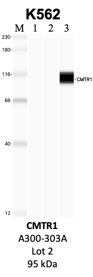 Bethyl_A300-303A_2_CMTR1.png<br>Caption: IP-WB analysis of K562 whole cell lysate using the CMTR1 specific antibody, A300-303A. Lanes 1 and 2 are 2.5% of five million whole cell lysate input and 50% of IP enrichment, respectively, using a normal IgG antibody. Lane 3 is 50% of IP enrichment from five million whole cell lysate using the CMTR1-specific antibody, A300-303A. The same antibody was used to detect protein levels via Western blot. This antibody passes preliminary validation and will be further pursued for secondary validation. *NOTE* Protein sizes are taken from Genecards.org and are only estimates based on sequence. Actual protein size may differ based on protein characteristics and electrophoresis method used.