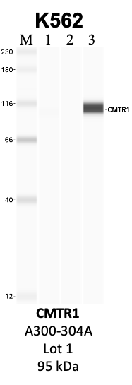 Bethyl_A300-304A_1_CMTR1.png<br>Caption: IP-WB analysis of K562 whole cell lysate using the CMTR1 specific antibody, A300-304A. Lanes 1 and 2 are 2.5% of five million whole cell lysate input and 50% of IP enrichment, respectively, using a normal IgG antibody. Lane 3 is 50% of IP enrichment from five million whole cell lysate using the CMTR1-specific antibody, A300-304A. The same antibody was used to detect protein levels via Western blot. This antibody passes preliminary validation and will be further pursued for secondary validation. *NOTE* Protein sizes are taken from Genecards.org and are only estimates based on sequence. Actual protein size may differ based on protein characteristics and electrophoresis method used.