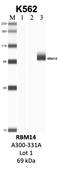 Bethyl_A300-331A_1_RBM14.png<br>Caption: IP-WB analysis of K562 whole cell lysate using the RBM14 specific antibody, A300-331A. Lanes 1 and 2 are 2.5% of five million whole cell lysate input and 50% of IP enrichment, respectively, using a normal IgG antibody. Lane 3 is 50% of IP enrichment from five million whole cell lysate using the RBM14-specific antibody, A300-331A. The same antibody was used to detect protein levels via Western blot. This antibody passes preliminary validation and will be further pursued for secondary validation. *NOTE* Protein sizes are taken from Genecards.org and are only estimates based on sequence. Actual protein size may differ based on protein characteristics and electrophoresis method used.