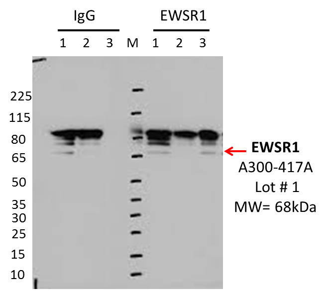 Bethyl_A300-417A_1_EWSR1_K562.png<br>Caption: IP-Western Blot analysis of K562 whole cell lysate using EWSR1 specific antibody. Lane 1 is 2.5% of 0.5mg input lysate, lane 2 is 2.5% of supernatant after immunoprecipitation and Lane 3 is 50% of IP enrichment using either rabbit polyclonal anti-EWSR1 antibody (lanes under 'EWSR1') or using rabbit normal IgG (lanes under 'IgG').