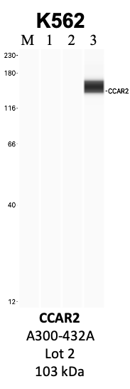 Bethyl_A300-432A_2_CCAR2.png<br>Caption: IP-WB analysis of K562 whole cell lysate using the CCAR2 specific antibody, A300-432A. Lanes 1 and 2 are 2.5% of five million whole cell lysate input and 50% of IP enrichment, respectively, using a normal IgG antibody. Lane 3 is 50% of IP enrichment from five million whole cell lysate using the CCAR2-specific antibody, A300-432A. The same antibody was used to detect protein levels via Western blot. This antibody passes preliminary validation and will be further pursued for secondary validation. *NOTE* Protein sizes are taken from Genecards.org and are only estimates based on sequence. Actual protein size may differ based on protein characteristics and electrophoresis method used.