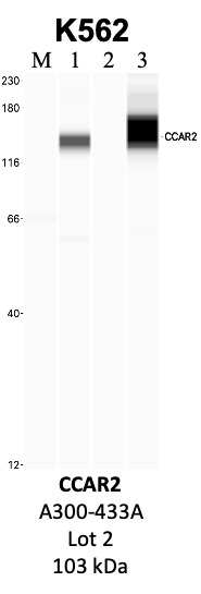 Bethyl_A300-433A_2_CCAR2.png<br>Caption: IP-WB analysis of K562 whole cell lysate using the CCAR2 specific antibody, A300-433A. Lanes 1 and 2 are 2.5% of five million whole cell lysate input and 50% of IP enrichment, respectively, using a normal IgG antibody. Lane 3 is 50% of IP enrichment from five million whole cell lysate using the CCAR2-specific antibody, A300-433A. The same antibody was used to detect protein levels via Western blot. This antibody passes preliminary validation and will be further pursued for secondary validation. *NOTE* Protein sizes are taken from Genecards.org and are only estimates based on sequence. Actual protein size may differ based on protein characteristics and electrophoresis method used.