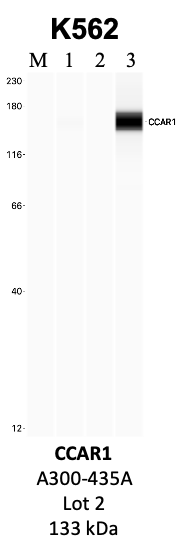 Bethyl_A300-435A_2_CCAR1.png<br>Caption: IP-WB analysis of K562 whole cell lysate using the CCAR1 specific antibody, A300-435A. Lanes 1 and 2 are 2.5% of five million whole cell lysate input and 50% of IP enrichment, respectively, using a normal IgG antibody. Lane 3 is 50% of IP enrichment from five million whole cell lysate using the CCAR1-specific antibody, A300-435A. The same antibody was used to detect protein levels via Western blot. This antibody passes preliminary validation and will be further pursued for secondary validation. *NOTE* Protein sizes are taken from Genecards.org and are only estimates based on sequence. Actual protein size may differ based on protein characteristics and electrophoresis method used.