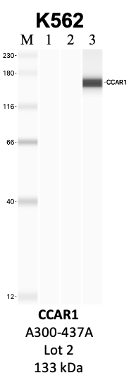 Bethyl_A300-437A_2_CCAR1.png<br>Caption: IP-WB analysis of K562 whole cell lysate using the CCAR1 specific antibody, A300-437A. Lanes 1 and 2 are 2.5% of five million whole cell lysate input and 50% of IP enrichment, respectively, using a normal IgG antibody. Lane 3 is 50% of IP enrichment from five million whole cell lysate using the CCAR1-specific antibody, A300-437A. The same antibody was used to detect protein levels via Western blot. This antibody passes preliminary validation and will be further pursued for secondary validation. *NOTE* Protein sizes are taken from Genecards.org and are only estimates based on sequence. Actual protein size may differ based on protein characteristics and electrophoresis method used.