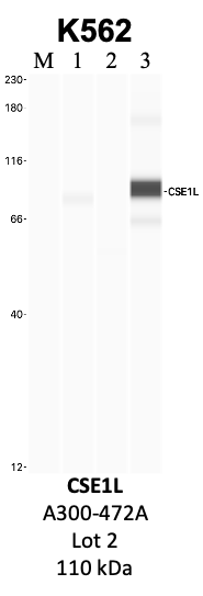 Bethyl_A300-472A_2_CSE1L.png<br>Caption: IP-WB analysis of K562 whole cell lysate using the CSE1L specific antibody, A300-472A. Lanes 1 and 2 are 2.5% of five million whole cell lysate input and 50% of IP enrichment, respectively, using a normal IgG antibody. Lane 3 is 50% of IP enrichment from five million whole cell lysate using the CSE1L-specific antibody, A300-472A. The same antibody was used to detect protein levels via Western blot. This antibody passes preliminary validation and will be further pursued for secondary validation. *NOTE* Protein sizes are taken from Genecards.org and are only estimates based on sequence. Actual protein size may differ based on protein characteristics and electrophoresis method used.