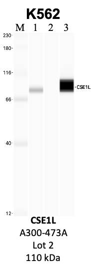 Bethyl_A300-473A_2_CSE1L.png<br>Caption: IP-WB analysis of K562 whole cell lysate using the CSE1L specific antibody, A300-473A. Lanes 1 and 2 are 2.5% of five million whole cell lysate input and 50% of IP enrichment, respectively, using a normal IgG antibody. Lane 3 is 50% of IP enrichment from five million whole cell lysate using the CSE1L-specific antibody, A300-473A. The same antibody was used to detect protein levels via Western blot. This antibody passes preliminary validation and will be further pursued for secondary validation. *NOTE* Protein sizes are taken from Genecards.org and are only estimates based on sequence. Actual protein size may differ based on protein characteristics and electrophoresis method used.