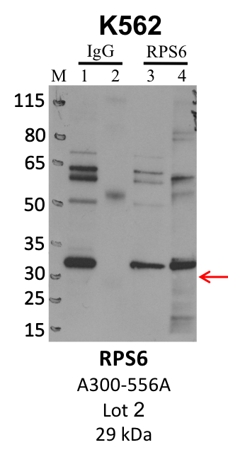 Bethyl_A300-556A_2_RPS6.png<br>Caption: IP-WB analysis of K562 whole cell lysate using the RPS6 specific antibody, A300-556A. Lanes 1 and 3 are 2.5% of five million whole cell lysate input. Lanes 2 and 4 are 50% of IP enrichment from five million whole cell lysate using normal IgG antibody and the RPS6-specific antibody, A300-556A. The same antibody was used to detect protein levels via Western blot. This antibody passes preliminary validation and will be further pursued for secondary validation. *NOTE* Protein sizes are taken from Genecards.org and are only estimates based on sequence. Actual protein size may differ based on protein characteristics and electrophoresis method used.