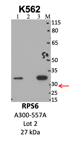 Bethyl_A300-557A_2_RPS6.png<br>Caption: IP-WB analysis of K562 whole cell lysate using the RPS6 specific antibody, A300-557A. Lanes 1 and 2 are 2.5% of five million whole cell lysate input and 50% of IP enrichment, respectively, using a normal IgG antibody. Lane 3 is 50% of IP enrichment from five million whole cell lysate using the RPS6-specific antibody, A300-557A. The same antibody was used to detect protein levels via Western blot. This antibody passes preliminary validation and will be further pursued for secondary validation. *NOTE* Protein sizes are taken from Genecards.org and are only estimates based on sequence. Actual protein size may differ based on protein characteristics and electrophoresis method used.