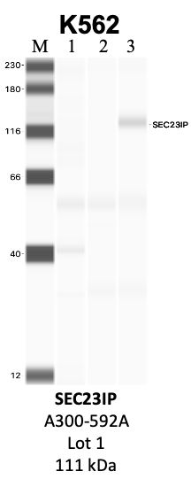 Bethyl_A300-592A_1_SEC23IP.png<br>Caption: IP-WB analysis of K562 whole cell lysate using the SEC23IP specific antibody, A300-592A. Lanes 1 and 2 are 2.5% of five million whole cell lysate input and 50% of IP enrichment, respectively, using a normal IgG antibody. Lane 3 is 50% of IP enrichment from five million whole cell lysate using the SEC23IP-specific antibody, A300-592A. The same antibody was used to detect protein levels via Western blot. This antibody passes preliminary validation and will be further pursued for secondary validation. *NOTE* Protein sizes are taken from Genecards.org and are only estimates based on sequence. Actual protein size may differ based on protein characteristics and electrophoresis method used.