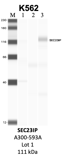 Bethyl_A300-594A_1_SEC23IP.png<br>Caption: IP-WB analysis of K562 whole cell lysate using the SEC23IP specific antibody, A300-594A. Lanes 1 and 2 are 2.5% of five million whole cell lysate input and 50% of IP enrichment, respectively, using a normal IgG antibody. Lane 3 is 50% of IP enrichment from five million whole cell lysate using the SEC23IP-specific antibody, A300-594A. The same antibody was used to detect protein levels via Western blot. This antibody passes preliminary validation and will be further pursued for secondary validation. *NOTE* Protein sizes are taken from Genecards.org and are only estimates based on sequence. Actual protein size may differ based on protein characteristics and electrophoresis method used.