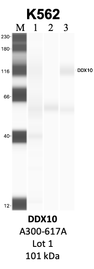 Bethyl_A300-617A_1_DDX10.png<br>Caption: IP-WB analysis of K562 whole cell lysate using the DDX10 specific antibody, A300-617A. Lanes 1 and 2 are 2.5% of five million whole cell lysate input and 50% of IP enrichment, respectively, using a normal IgG antibody. Lane 3 is 50% of IP enrichment from five million whole cell lysate using the DDX10-specific antibody, A300-617A. The same antibody was used to detect protein levels via Western blot. This antibody passes preliminary validation and will be further pursued for secondary validation. *NOTE* Protein sizes are taken from Genecards.org and are only estimates based on sequence. Actual protein size may differ based on protein characteristics and electrophoresis method used.