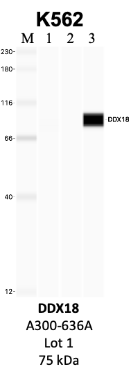 Bethyl_A300-636A_1_DDX18.png<br>Caption: IP-WB analysis of K562 whole cell lysate using the DDX18 specific antibody, A300-636A. Lanes 1 and 2 are 2.5% of five million whole cell lysate input and 50% of IP enrichment, respectively, using a normal IgG antibody. Lane 3 is 50% of IP enrichment from five million whole cell lysate using the DDX18-specific antibody, A300-636A. The same antibody was used to detect protein levels via Western blot. This antibody passes preliminary validation and will be further pursued for secondary validation. *NOTE* Protein sizes are taken from Genecards.org and are only estimates based on sequence. Actual protein size may differ based on protein characteristics and electrophoresis method used.