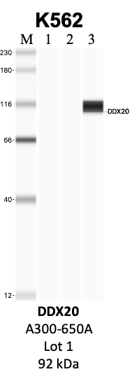 Bethyl_A300-650A_1_DDX20.png<br>Caption: IP-WB analysis of K562 whole cell lysate using the DDX20 specific antibody, A300-650A. Lanes 1 and 2 are 2.5% of five million whole cell lysate input and 50% of IP enrichment, respectively, using a normal IgG antibody. Lane 3 is 50% of IP enrichment from five million whole cell lysate using the DDX20-specific antibody, A300-650A. The same antibody was used to detect protein levels via Western blot. This antibody passes preliminary validation and will be further pursued for secondary validation. *NOTE* Protein sizes are taken from Genecards.org and are only estimates based on sequence. Actual protein size may differ based on protein characteristics and electrophoresis method used.