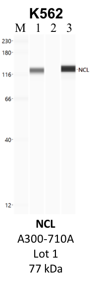 Bethyl_A300-710A_1_NCL.png<br>Caption: IP-WB analysis of K562 whole cell lysate using the NCL specific antibody, A300-710A. Lane 1 is 2.5% of five million whole cell lysate input. Lanes 2 and 3 are 50% of IP enrichment from five million whole cell lysate using normal IgG antibody and the NCL-specific antibody, A300-710A. The same antibody was used to detect protein levels via Western blot. This antibody passes preliminary validation and will be further pursued for secondary validation. *NOTE* Protein sizes are taken from Genecards.org and are only estimates based on sequence. Actual protein size may differ based on protein characteristics and electrophoresis method used.