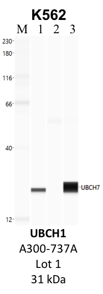 Bethyl_A300-737A_1_UBCH7.png<br>Caption: IP-WB analysis of K562 whole cell lysate using the UBCH7 specific antibody, A300-737A. Lane 1 is 2.5% of five million whole cell lysate input. Lanes 2 and 3 are 50% of IP enrichment from five million whole cell lysate using normal IgG antibody and the UBCH7-specific antibody, A300-737A. The same antibody was used to detect protein levels via Western blot. This antibody passes preliminary validation and will be further pursued for secondary validation. *NOTE* Protein sizes are taken from Genecards.org and are only estimates based on sequence. Actual protein size may differ based on protein characteristics and electrophoresis method used.