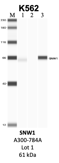 Bethyl_A300-784A_1_SNW1.png<br>Caption: IP-WB analysis of K562 whole cell lysate using the SNW1 specific antibody, A300-784A. Lanes 1 and 2 are 2.5% of five million whole cell lysate input and 50% of IP enrichment, respectively, using a normal IgG antibody. Lane 3 is 50% of IP enrichment from five million whole cell lysate using the SNW1-specific antibody, A300-784A. The same antibody was used to detect protein levels via Western blot. This antibody passes preliminary validation and will be further pursued for secondary validation. *NOTE* Protein sizes are taken from Genecards.org and are only estimates based on sequence. Actual protein size may differ based on protein characteristics and electrophoresis method used.