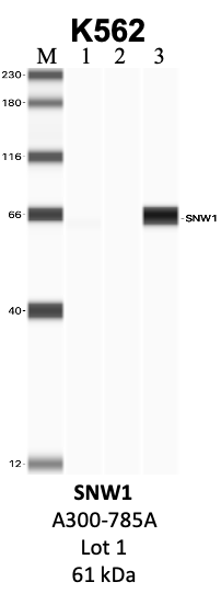 Bethyl_A300-785A_1_SNW1.png<br>Caption: IP-WB analysis of K562 whole cell lysate using the SNW1 specific antibody, A300-785A. Lanes 1 and 2 are 2.5% of five million whole cell lysate input and 50% of IP enrichment, respectively, using a normal IgG antibody. Lane 3 is 50% of IP enrichment from five million whole cell lysate using the SNW1-specific antibody, A300-785A. The same antibody was used to detect protein levels via Western blot. This antibody passes preliminary validation and will be further pursued for secondary validation. *NOTE* Protein sizes are taken from Genecards.org and are only estimates based on sequence. Actual protein size may differ based on protein characteristics and electrophoresis method used.