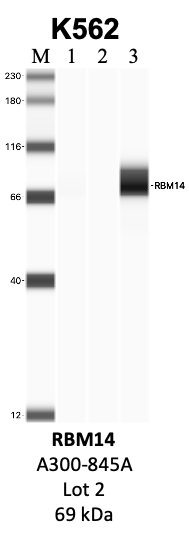 Bethyl_A300-845A_2_RBM14.png<br>Caption: IP-WB analysis of K562 whole cell lysate using the RBM14 specific antibody, A300-845A. Lanes 1 and 2 are 2.5% of five million whole cell lysate input and 50% of IP enrichment, respectively, using a normal IgG antibody. Lane 3 is 50% of IP enrichment from five million whole cell lysate using the RBM14-specific antibody, A300-845A. The same antibody was used to detect protein levels via Western blot. This antibody passes preliminary validation and will be further pursued for secondary validation. *NOTE* Protein sizes are taken from Genecards.org and are only estimates based on sequence. Actual protein size may differ based on protein characteristics and electrophoresis method used.