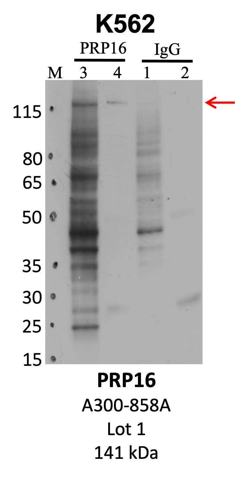 Bethyl_A300-858A_1_PRP16.png<br>Caption: IP-WB analysis of K562 whole cell lysate using the PRP16 specific antibody, A300-858A. Lanes 1 and 3 are 2.5% of five million whole cell lysate input. Lanes 2 and 4 are 50% of IP enrichment from five million whole cell lysate using normal IgG antibody and the PRP16-specific antibody, A300-858A. The same antibody was used to detect protein levels via Western blot. This antibody passes preliminary validation and will be further pursued for secondary validation. *NOTE* Protein sizes are taken from Genecards.org and are only estimates based on sequence. Actual protein size may differ based on protein characteristics and electrophoresis method used.