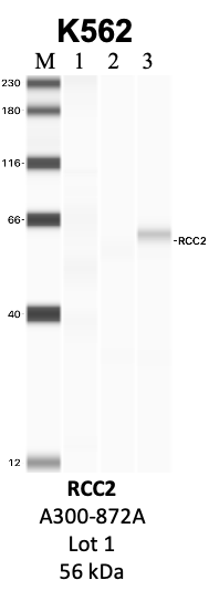 Bethyl_A300-872A_1_RCC2.png<br>Caption: IP-WB analysis of K562 whole cell lysate using the RCC2 specific antibody, A300-872A. Lanes 1 and 2 are 2.5% of five million whole cell lysate input and 50% of IP enrichment, respectively, using a normal IgG antibody. Lane 3 is 50% of IP enrichment from five million whole cell lysate using the RCC2-specific antibody, A300-872A. The same antibody was used to detect protein levels via Western blot. This antibody passes preliminary validation and will be further pursued for secondary validation. *NOTE* Protein sizes are taken from Genecards.org and are only estimates based on sequence. Actual protein size may differ based on protein characteristics and electrophoresis method used.