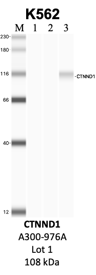 Bethyl_A300-976A_1_CTNND1.png<br>Caption: IP-WB analysis of K562 whole cell lysate using the CTNND1 specific antibody, A300-976A. Lanes 1 and 2 are 2.5% of five million whole cell lysate input and 50% of IP enrichment, respectively, using a normal IgG antibody. Lane 3 is 50% of IP enrichment from five million whole cell lysate using the CTNND1-specific antibody, A300-976A. The same antibody was used to detect protein levels via Western blot. This antibody passes preliminary validation and will be further pursued for secondary validation. *NOTE* Protein sizes are taken from Genecards.org and are only estimates based on sequence. Actual protein size may differ based on protein characteristics and electrophoresis method used.