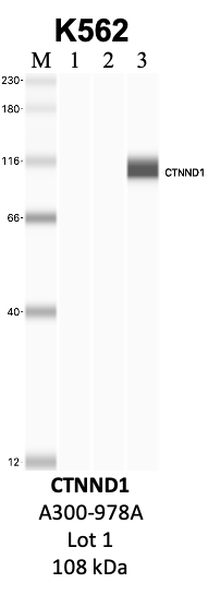 Bethyl_A300-978A_1_CTNND1.png<br>Caption: IP-WB analysis of K562 whole cell lysate using the CTNND1 specific antibody, A300-978A. Lanes 1 and 2 are 2.5% of five million whole cell lysate input and 50% of IP enrichment, respectively, using a normal IgG antibody. Lane 3 is 50% of IP enrichment from five million whole cell lysate using the CTNND1-specific antibody, A300-978A. The same antibody was used to detect protein levels via Western blot. This antibody passes preliminary validation and will be further pursued for secondary validation. *NOTE* Protein sizes are taken from Genecards.org and are only estimates based on sequence. Actual protein size may differ based on protein characteristics and electrophoresis method used.