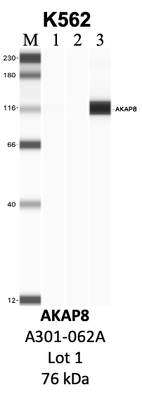 Bethyl_A301-062A_1_AKAP8.png<br>Caption: IP-WB analysis of K562 whole cell lysate using the AKAP8 specific antibody, A301-062A. Lanes 1 and 2 are 2.5% of five million whole cell lysate input and 50% of IP enrichment, respectively, using a normal IgG antibody. Lane 3 is 50% of IP enrichment from five million whole cell lysate using the AKAP8-specific antibody, A301-062A. The same antibody was used to detect protein levels via Western blot. This antibody passes preliminary validation and will be further pursued for secondary validation. *NOTE* Protein sizes are taken from Genecards.org and are only estimates based on sequence. Actual protein size may differ based on protein characteristics and electrophoresis method used.