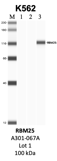 Bethyl_A301-067A_1_RBM25.png<br>Caption: IP-WB analysis of K562 whole cell lysate using the RBM25 specific antibody, A301-067A. Lanes 1 and 2 are 2.5% of five million whole cell lysate input and 50% of IP enrichment, respectively, using a normal IgG antibody. Lane 3 is 50% of IP enrichment from five million whole cell lysate using the RBM25-specific antibody, A301-067A. The same antibody was used to detect protein levels via Western blot. This antibody passes preliminary validation and will be further pursued for secondary validation. *NOTE* Protein sizes are taken from Genecards.org and are only estimates based on sequence. Actual protein size may differ based on protein characteristics and electrophoresis method used.