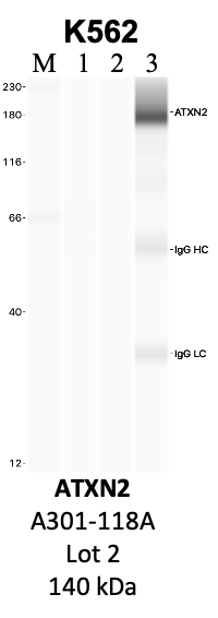 Bethyl_A301-118A_2_ATXN2.png<br>Caption: IP-WB analysis of K562 whole cell lysate using the ATXN2 specific antibody, A301-118A. Lanes 1 and 2 are 2.5% of five million whole cell lysate input and 50% of IP enrichment, respectively, using a normal IgG antibody. Lane 3 is 50% of IP enrichment from five million whole cell lysate using the ATXN2-specific antibody, A301-118A. The same antibody was used to detect protein levels via Western blot. This antibody passes preliminary validation and will be further pursued for secondary validation. *NOTE* Protein sizes are taken from Genecards.org and are only estimates based on sequence. Actual protein size may differ based on protein characteristics and electrophoresis method used.