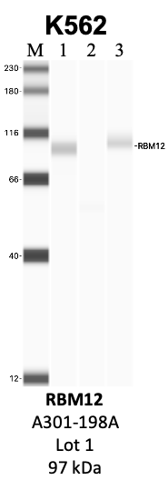 Bethyl_A301-198A_1_RBM12.png<br>Caption: IP-WB analysis of K562 whole cell lysate using the RBM12 specific antibody, A301-198A. Lanes 1 and 2 are 2.5% of five million whole cell lysate input and 50% of IP enrichment, respectively, using a normal IgG antibody. Lane 3 is 50% of IP enrichment from five million whole cell lysate using the RBM12-specific antibody, A301-198A. The same antibody was used to detect protein levels via Western blot. This antibody passes preliminary validation and will be further pursued for secondary validation. *NOTE* Protein sizes are taken from Genecards.org and are only estimates based on sequence. Actual protein size may differ based on protein characteristics and electrophoresis method used.