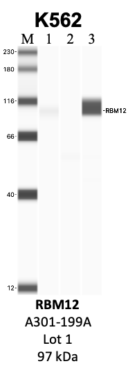 Bethyl_A301-199A_1_RBM12.png<br>Caption: IP-WB analysis of K562 whole cell lysate using the RBM12 specific antibody, A301-199A. Lanes 1 and 2 are 2.5% of five million whole cell lysate input and 50% of IP enrichment, respectively, using a normal IgG antibody. Lane 3 is 50% of IP enrichment from five million whole cell lysate using the RBM12-specific antibody, A301-199A. The same antibody was used to detect protein levels via Western blot. This antibody passes preliminary validation and will be further pursued for secondary validation. *NOTE* Protein sizes are taken from Genecards.org and are only estimates based on sequence. Actual protein size may differ based on protein characteristics and electrophoresis method used.