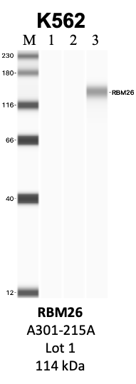 Bethyl_A301-215A_1_RBM26.png<br>Caption: IP-WB analysis of K562 whole cell lysate using the RBM26 specific antibody, A301-215A. Lanes 1 and 2 are 2.5% of five million whole cell lysate input and 50% of IP enrichment, respectively, using a normal IgG antibody. Lane 3 is 50% of IP enrichment from five million whole cell lysate using the RBM26-specific antibody, A301-215A. The same antibody was used to detect protein levels via Western blot. This antibody passes preliminary validation and will be further pursued for secondary validation. *NOTE* Protein sizes are taken from Genecards.org and are only estimates based on sequence. Actual protein size may differ based on protein characteristics and electrophoresis method used.