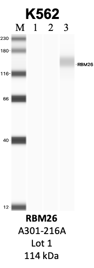 Bethyl_A301-216A_1_RBM26.png<br>Caption: IP-WB analysis of K562 whole cell lysate using the RBM26 specific antibody, A301-216A. Lanes 1 and 2 are 2.5% of five million whole cell lysate input and 50% of IP enrichment, respectively, using a normal IgG antibody. Lane 3 is 50% of IP enrichment from five million whole cell lysate using the RBM26-specific antibody, A301-216A. The same antibody was used to detect protein levels via Western blot. This antibody passes preliminary validation and will be further pursued for secondary validation. *NOTE* Protein sizes are taken from Genecards.org and are only estimates based on sequence. Actual protein size may differ based on protein characteristics and electrophoresis method used.