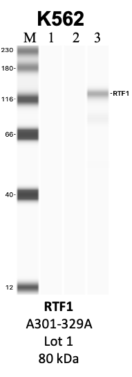 Bethyl_A301-329A_1_RTF1.png<br>Caption: IP-WB analysis of K562 whole cell lysate using the RTF1 specific antibody, A301-329A. Lanes 1 and 2 are 2.5% of five million whole cell lysate input and 50% of IP enrichment, respectively, using a normal IgG antibody. Lane 3 is 50% of IP enrichment from five million whole cell lysate using the RTF1-specific antibody, A301-329A. The same antibody was used to detect protein levels via Western blot. This antibody passes preliminary validation and will be further pursued for secondary validation. *NOTE* Protein sizes are taken from Genecards.org and are only estimates based on sequence. Actual protein size may differ based on protein characteristics and electrophoresis method used.