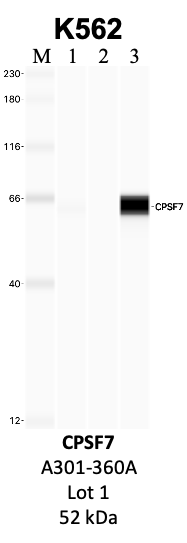 Bethyl_A301-360A_1_CPSF7.png<br>Caption: IP-WB analysis of K562 whole cell lysate using the CPSF7 specific antibody, A301-360A. Lanes 1 and 2 are 2.5% of five million whole cell lysate input and 50% of IP enrichment, respectively, using a normal IgG antibody. Lane 3 is 50% of IP enrichment from five million whole cell lysate using the CPSF7-specific antibody, A301-360A. The same antibody was used to detect protein levels via Western blot. This antibody passes preliminary validation and will be further pursued for secondary validation. *NOTE* Protein sizes are taken from Genecards.org and are only estimates based on sequence. Actual protein size may differ based on protein characteristics and electrophoresis method used.