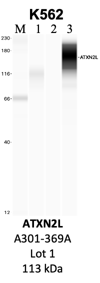 Bethyl_A301-369A_1_ATXN2L.png<br>Caption: IP-WB analysis of K562 whole cell lysate using the ATXN2L specific antibody, A301-369A. Lanes 1 and 2 are 2.5% of five million whole cell lysate input and 50% of IP enrichment, respectively, using a normal IgG antibody. Lane 3 is 50% of IP enrichment from five million whole cell lysate using the ATXN2L-specific antibody, A301-369A. The same antibody was used to detect protein levels via Western blot. This antibody passes preliminary validation and will be further pursued for secondary validation. *NOTE* Protein sizes are taken from Genecards.org and are only estimates based on sequence. Actual protein size may differ based on protein characteristics and electrophoresis method used.