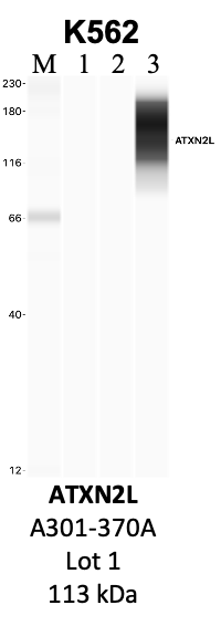 Bethyl_A301-370A_1_ATXN2L.png<br>Caption: IP-WB analysis of K562 whole cell lysate using the ATXN2L specific antibody, A301-370A. Lanes 1 and 2 are 2.5% of five million whole cell lysate input and 50% of IP enrichment, respectively, using a normal IgG antibody. Lane 3 is 50% of IP enrichment from five million whole cell lysate using the ATXN2L-specific antibody, A301-370A. The same antibody was used to detect protein levels via Western blot. This antibody passes preliminary validation and will be further pursued for secondary validation. *NOTE* Protein sizes are taken from Genecards.org and are only estimates based on sequence. Actual protein size may differ based on protein characteristics and electrophoresis method used.