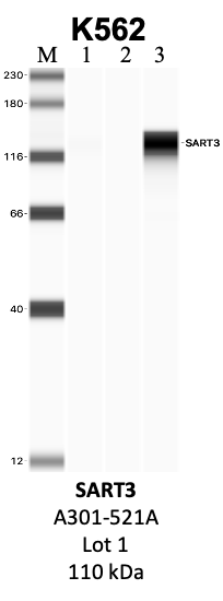 Bethyl_A301-521A_1_SART3.png<br>Caption: IP-WB analysis of K562 whole cell lysate using the SART3 specific antibody, A301-521A. Lanes 1 and 2 are 2.5% of five million whole cell lysate input and 50% of IP enrichment, respectively, using a normal IgG antibody. Lane 3 is 50% of IP enrichment from five million whole cell lysate using the SART3-specific antibody, A301-521A. The same antibody was used to detect protein levels via Western blot. This antibody passes preliminary validation and will be further pursued for secondary validation. *NOTE* Protein sizes are taken from Genecards.org and are only estimates based on sequence. Actual protein size may differ based on protein characteristics and electrophoresis method used.